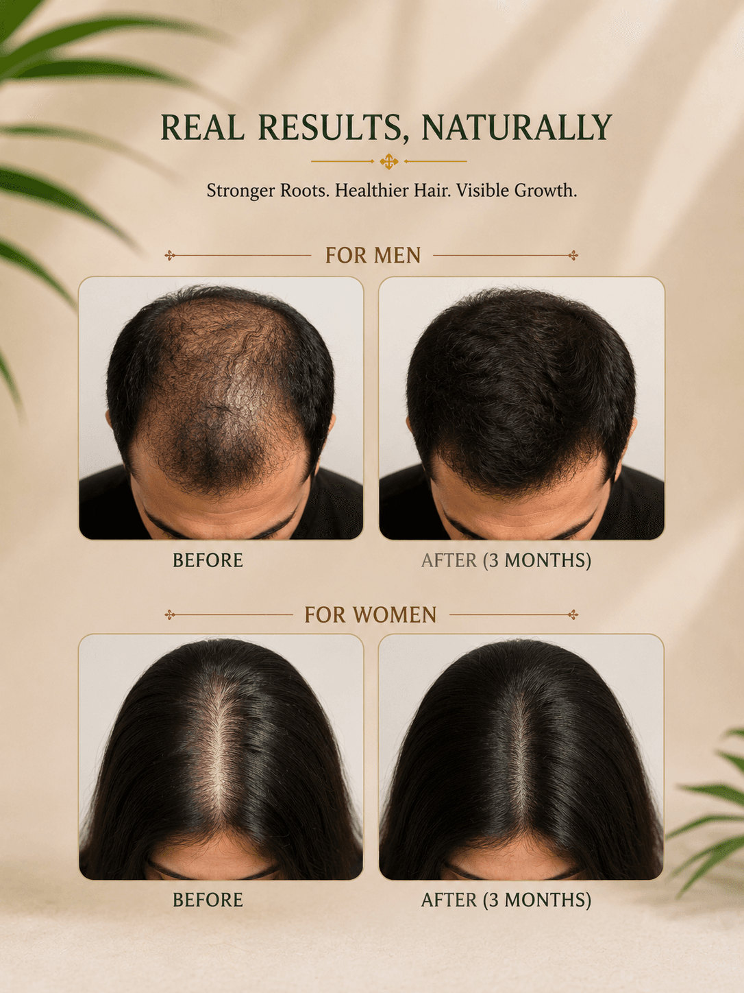 HairAyur Hair Care Combo (HairOil + Shampoo)